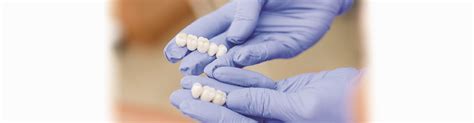 broken tooth west kelowna|Dental Implants, Bridges, Crowns, Veneers West Kelowna .